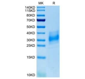 Tris-Bis PAGE - Recombinant Human CD147 Protein (C-terminal His Tag) (A331481) - Antibodies.com