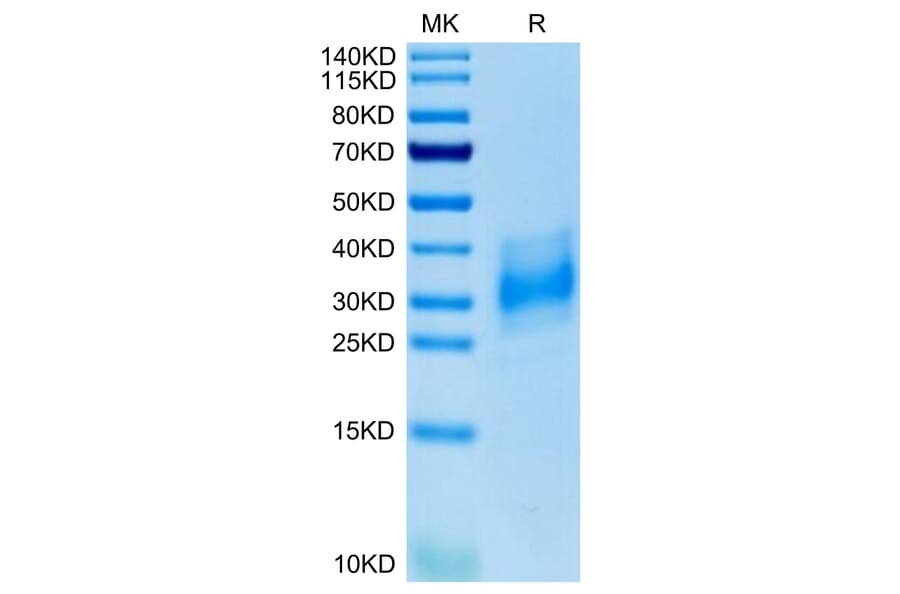 Tris-Bis PAGE - Recombinant Human CD147 Protein (C-terminal His Tag) (A331481) - Antibodies.com