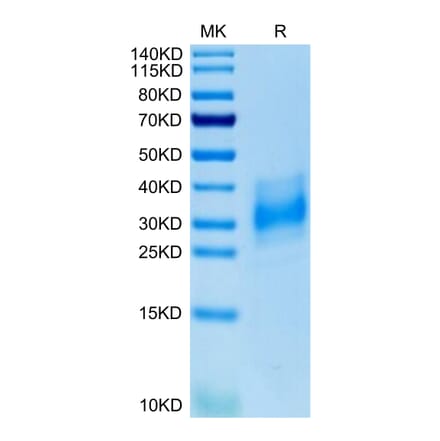 Tris-Bis PAGE - Recombinant Human CD147 Protein (C-terminal His Tag) (A331481) - Antibodies.com