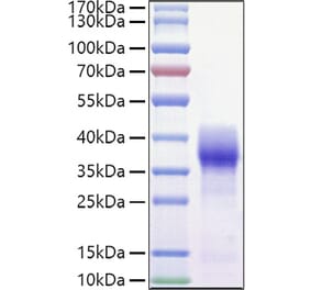 SDS-PAGE - Recombinant Mouse CD147 Protein (C-terminal His and Avi Tag) (A331482) - Antibodies.com