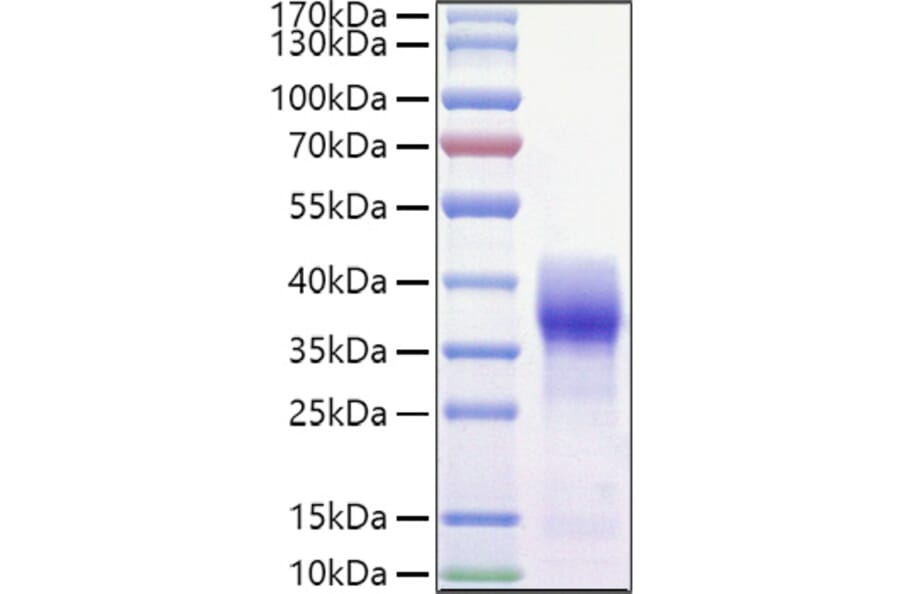 SDS-PAGE - Recombinant Mouse CD147 Protein (C-terminal His and Avi Tag) (A331482) - Antibodies.com