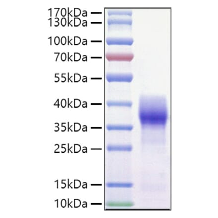 SDS-PAGE - Recombinant Mouse CD147 Protein (C-terminal His and Avi Tag) (A331482) - Antibodies.com