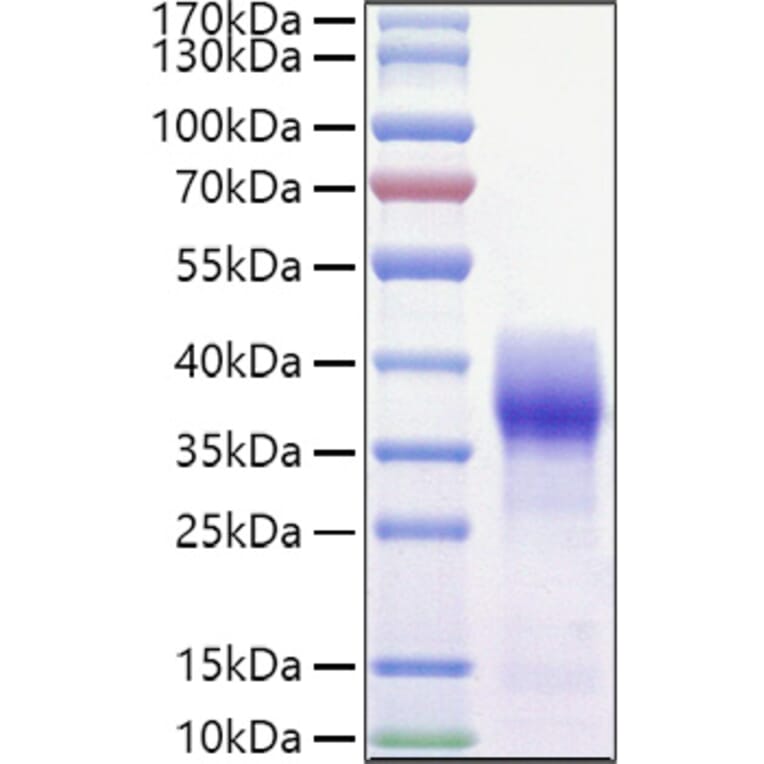 SDS-PAGE - Recombinant Mouse CD147 Protein (C-terminal His and Avi Tag) (A331482) - Antibodies.com