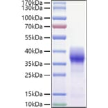 SDS-PAGE - Recombinant Mouse CD147 Protein (C-terminal His and Avi Tag) (A331482) - Antibodies.com