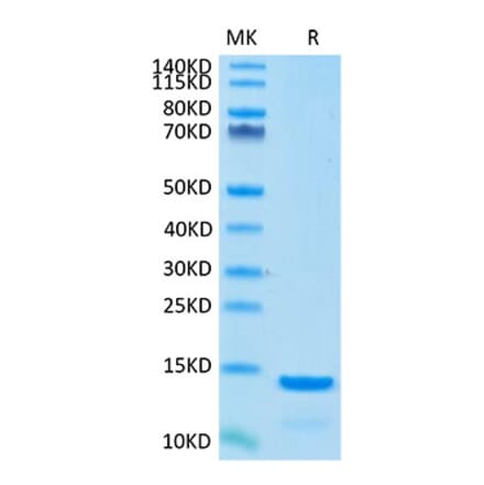 Tris-Bis PAGE - Recombinant Cynomolgus macaque beta 2 Microglobulin Protein (C-terminal His Tag) (A331483) - Antibodies.com