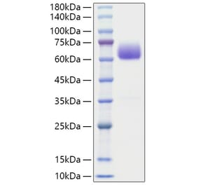 SDS-PAGE - Recombinant Mouse BTLA Protein (C-terminal Human Fc Tag) (A331485) - Antibodies.com