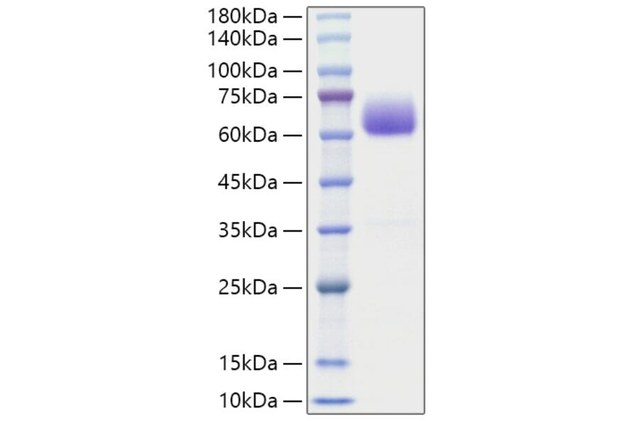 SDS-PAGE - Recombinant Mouse BTLA Protein (C-terminal Human Fc Tag) (A331485) - Antibodies.com