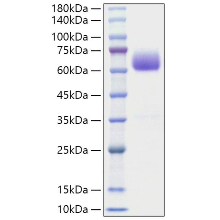 SDS-PAGE - Recombinant Mouse BTLA Protein (C-terminal Human Fc Tag) (A331485) - Antibodies.com