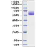 SDS-PAGE - Recombinant Mouse BTLA Protein (C-terminal Human Fc Tag) (A331485) - Antibodies.com