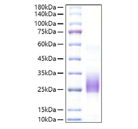 SDS-PAGE - Recombinant Mouse CD160 Protein (C-terminal His Tag) (A331486) - Antibodies.com