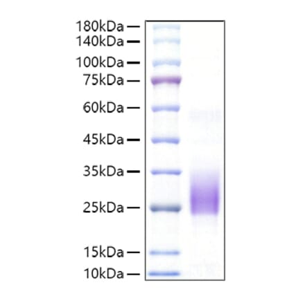 SDS-PAGE - Recombinant Mouse CD160 Protein (C-terminal His Tag) (A331486) - Antibodies.com