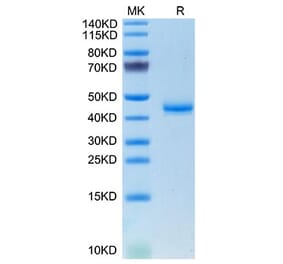 Tris-Bis PAGE - Recombinant Mouse Calcitonin Protein (C-terminal Human Fc Tag) (A331487) - Antibodies.com