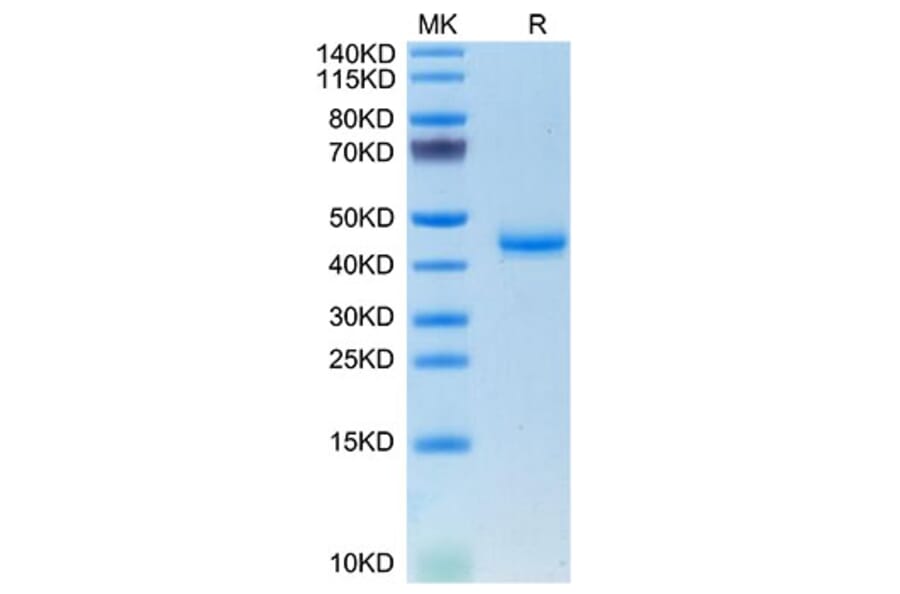Tris-Bis PAGE - Recombinant Mouse Calcitonin Protein (C-terminal Human Fc Tag) (A331487) - Antibodies.com