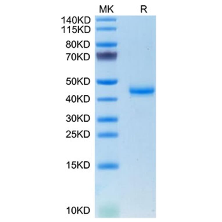 Tris-Bis PAGE - Recombinant Mouse Calcitonin Protein (C-terminal Human Fc Tag) (A331487) - Antibodies.com