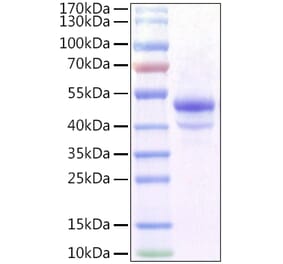 SDS-PAGE - Recombinant Mouse CA9 Protein (C-terminal His Tag) (A331489) - Antibodies.com