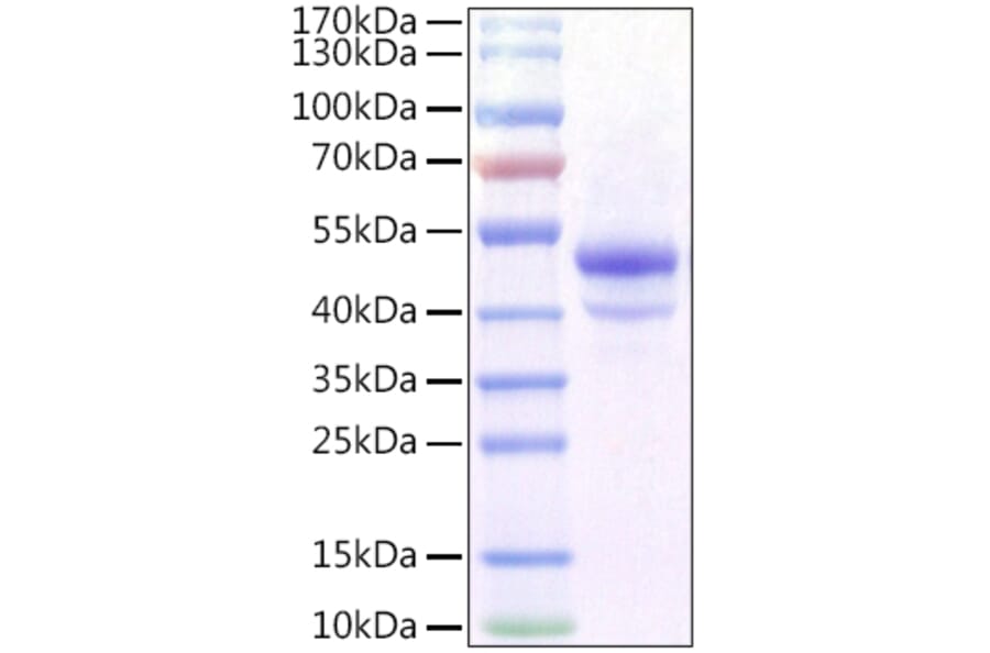 SDS-PAGE - Recombinant Mouse CA9 Protein (C-terminal His Tag) (A331489) - Antibodies.com