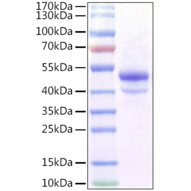 SDS-PAGE - Recombinant Mouse CA9 Protein (C-terminal His Tag) (A331489) - Antibodies.com