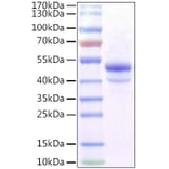 SDS-PAGE - Recombinant Mouse CA9 Protein (C-terminal His Tag) (A331489) - Antibodies.com