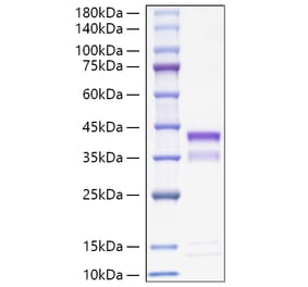 SDS-PAGE - Recombinant Mouse Cathepsin S Protein (C-terminal His Tag) (A331490) - Antibodies.com