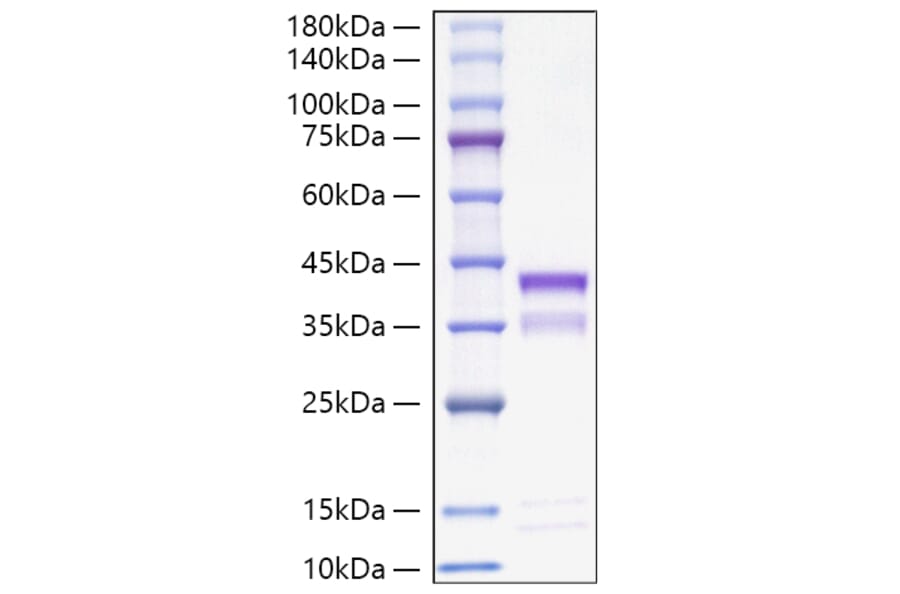 SDS-PAGE - Recombinant Mouse Cathepsin S Protein (C-terminal His Tag) (A331490) - Antibodies.com
