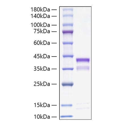 SDS-PAGE - Recombinant Mouse Cathepsin S Protein (C-terminal His Tag) (A331490) - Antibodies.com
