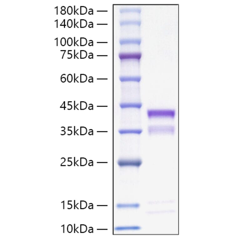 SDS-PAGE - Recombinant Mouse Cathepsin S Protein (C-terminal His Tag) (A331490) - Antibodies.com