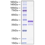 SDS-PAGE - Recombinant Mouse Cathepsin S Protein (C-terminal His Tag) (A331490) - Antibodies.com