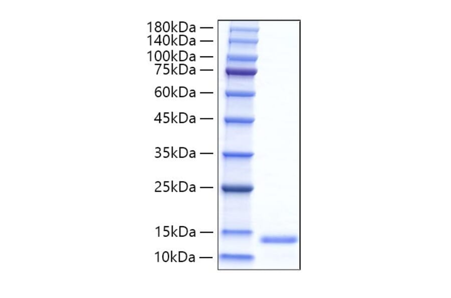 SDS-PAGE - Recombinant Mouse Eotaxin Protein (C-terminal His Tag) (A331491) - Antibodies.com