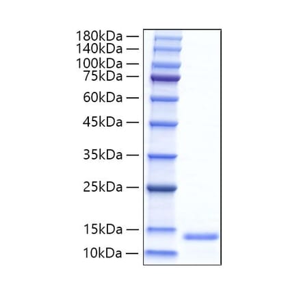 SDS-PAGE - Recombinant Mouse Eotaxin Protein (C-terminal His Tag) (A331491) - Antibodies.com