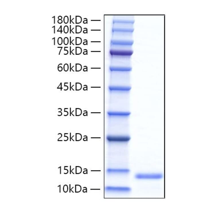SDS-PAGE - Recombinant Mouse Eotaxin Protein (C-terminal His Tag) (A331491) - Antibodies.com