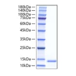 SDS-PAGE - Recombinant Mouse Eotaxin Protein (C-terminal His Tag) (A331491) - Antibodies.com