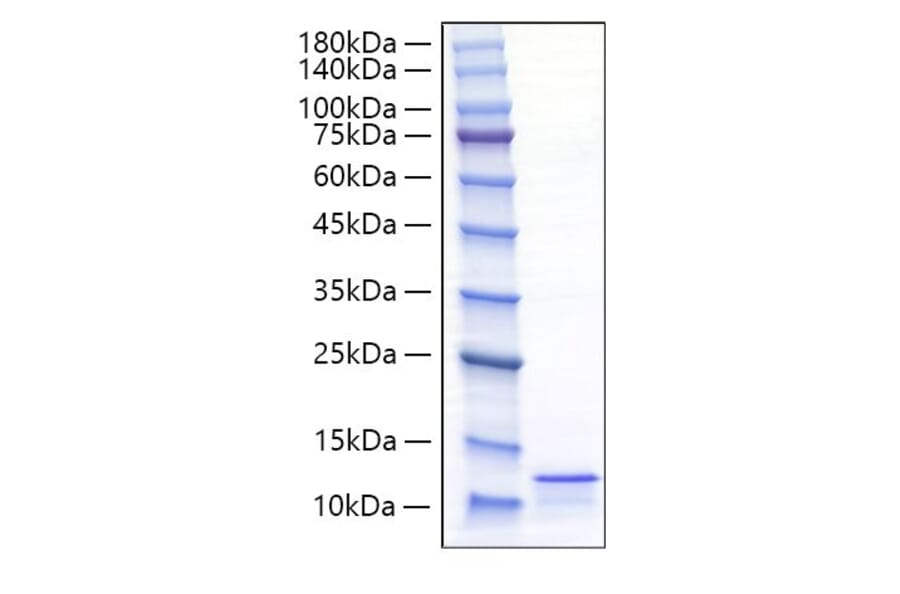 SDS-PAGE - Recombinant Mouse CCL17 Protein (C-terminal His Tag) (A331492) - Antibodies.com