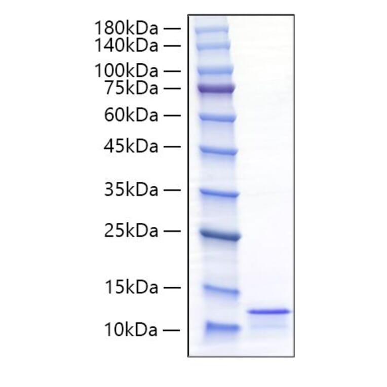 SDS-PAGE - Recombinant Mouse CCL17 Protein (C-terminal His Tag) (A331492) - Antibodies.com