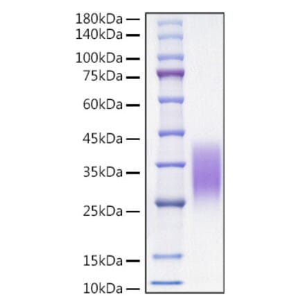 SDS-PAGE - Recombinant Mouse MCP1 Protein (C-terminal His Tag) (A331493) - Antibodies.com