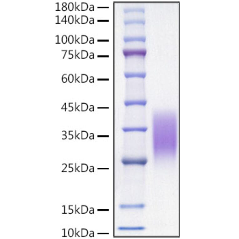 SDS-PAGE - Recombinant Mouse MCP1 Protein (C-terminal His Tag) (A331493) - Antibodies.com