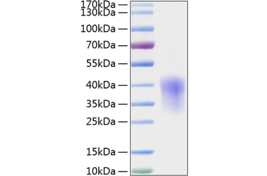 SDS-PAGE - Recombinant Rat MCP1 Protein (C-terminal His Tag) (A331495) - Antibodies.com