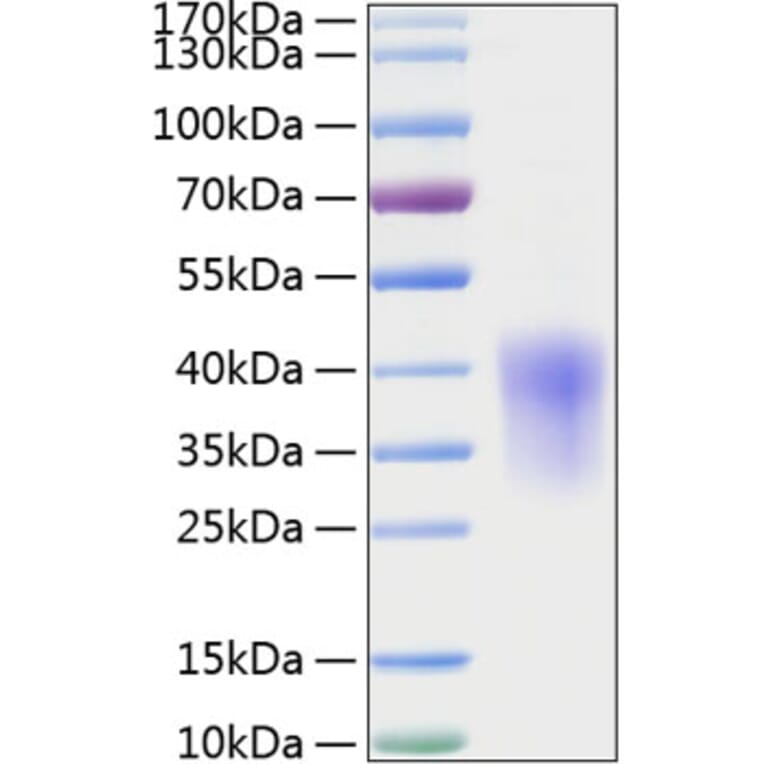 SDS-PAGE - Recombinant Rat MCP1 Protein (C-terminal His Tag) (A331495) - Antibodies.com