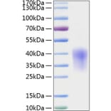 SDS-PAGE - Recombinant Rat MCP1 Protein (C-terminal His Tag) (A331495) - Antibodies.com