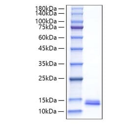 SDS-PAGE - Recombinant Mouse MDC Protein (C-terminal His Tag) (A331496) - Antibodies.com