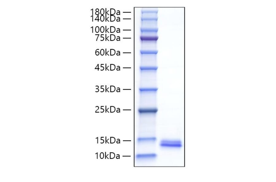 SDS-PAGE - Recombinant Mouse MDC Protein (C-terminal His Tag) (A331496) - Antibodies.com