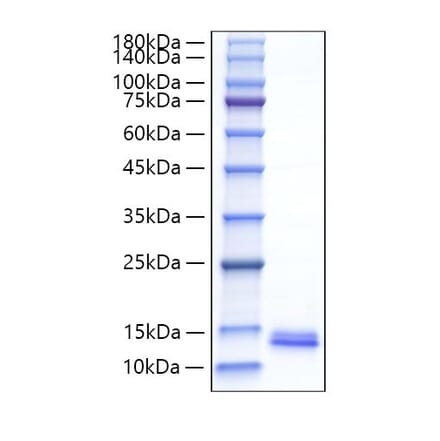 SDS-PAGE - Recombinant Mouse MDC Protein (C-terminal His Tag) (A331496) - Antibodies.com