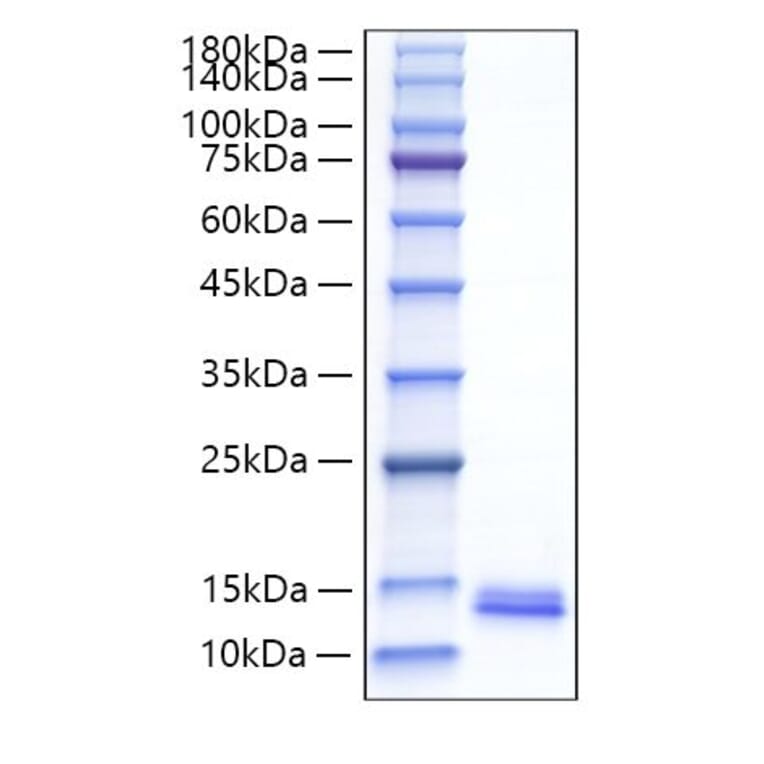 SDS-PAGE - Recombinant Mouse MDC Protein (C-terminal His Tag) (A331496) - Antibodies.com