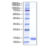 SDS-PAGE - Recombinant Mouse MDC Protein (C-terminal His Tag) (A331496) - Antibodies.com