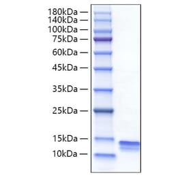 SDS-PAGE - Recombinant Mouse CCL4 Protein (C-terminal His Tag) (A331497) - Antibodies.com