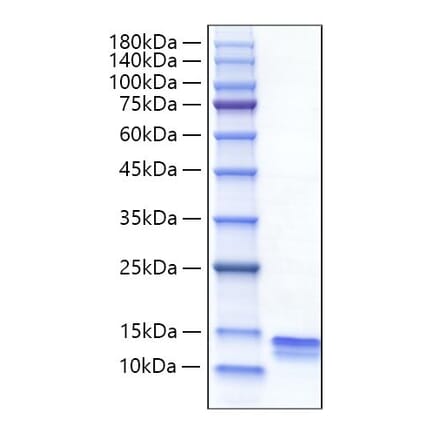 SDS-PAGE - Recombinant Mouse CCL4 Protein (C-terminal His Tag) (A331497) - Antibodies.com