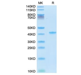 Tris-Bis PAGE - Recombinant Mouse RANTES Protein (N-terminal Human Fc Tag) (A331498) - Antibodies.com