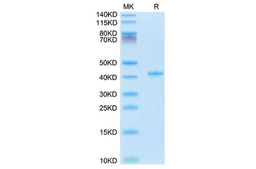 Tris-Bis PAGE - Recombinant Mouse RANTES Protein (N-terminal Human Fc Tag) (A331498) - Antibodies.com