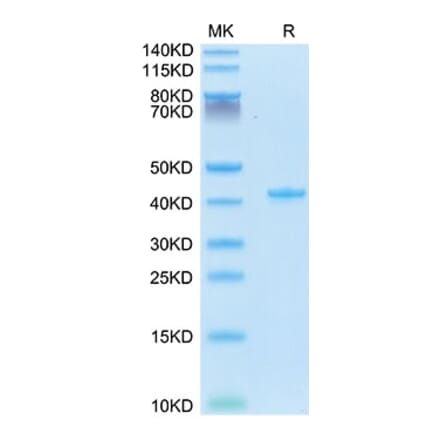 Tris-Bis PAGE - Recombinant Mouse RANTES Protein (N-terminal Human Fc Tag) (A331498) - Antibodies.com