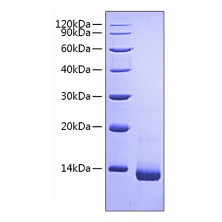 SDS-PAGE - Recombinant Rat RANTES Protein (N-terminal His Tag) (A331499) - Antibodies.com