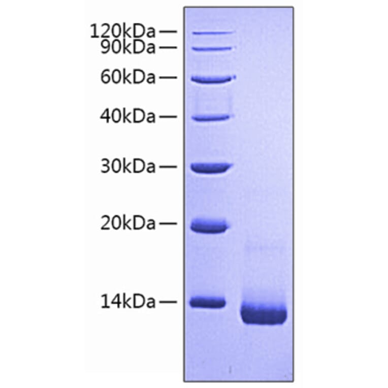 SDS-PAGE - Recombinant Rat RANTES Protein (N-terminal His Tag) (A331499) - Antibodies.com